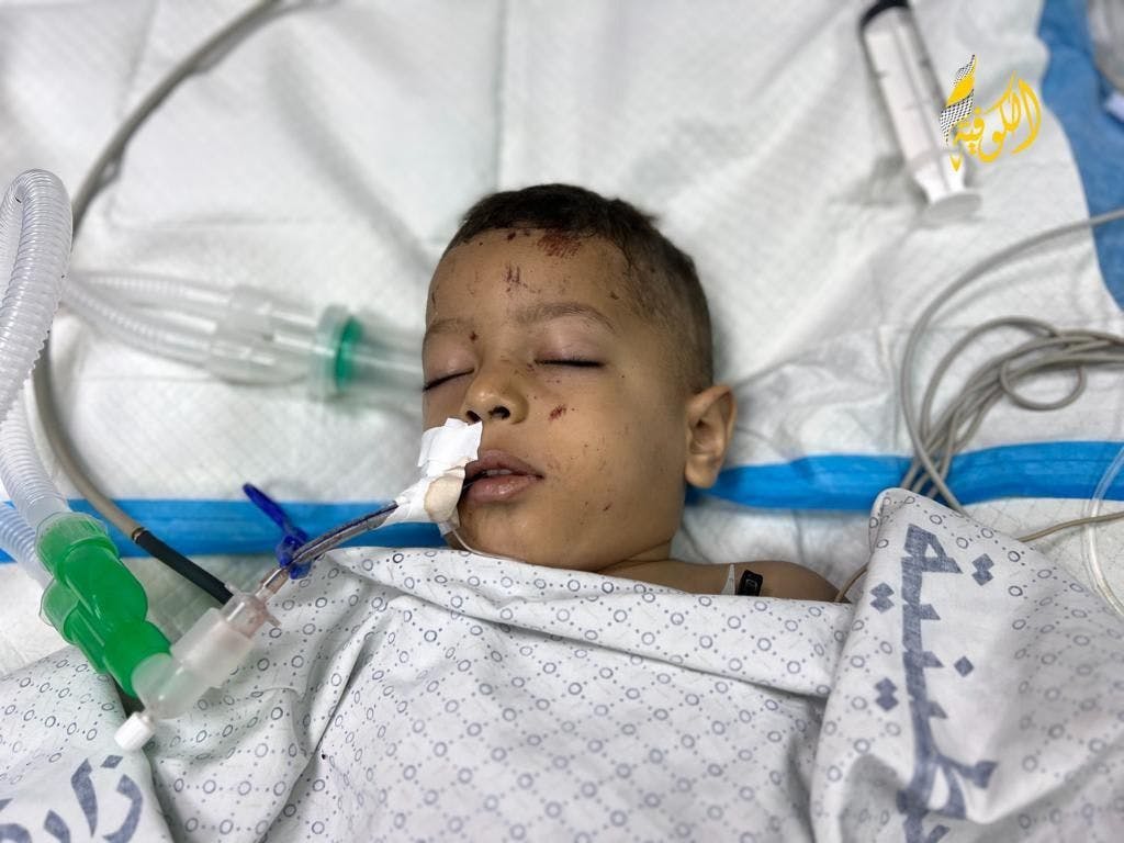 Wissam Abu Yusuf, a 3-year-old child, is the sole survivor of his family after being pulled out from under the rubble, due to Israeli bombing on their house. He is in intensive care due to the severity of his injuries.