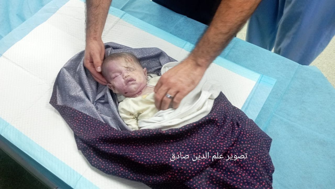 Miyan Yahya Al-Astal, was killed during a missile strike on their home in the center of Khan Yunis city.